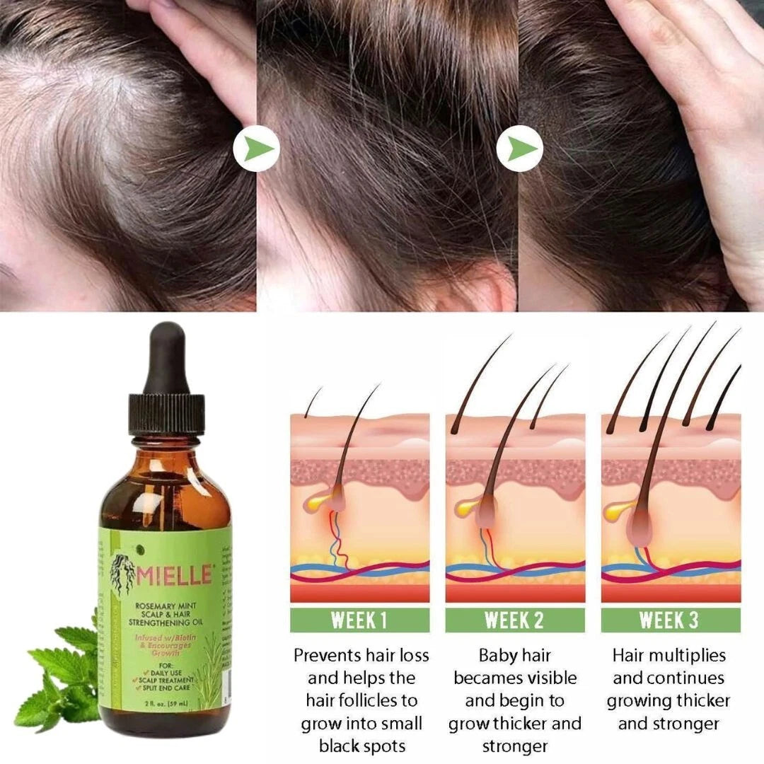 Mielle, Scalp & Hair Strengthening Oil, Rosemary Mint, 2 fl oz (59 ml)